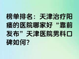 榜单排名：天津治疗阳痿的医院哪家好“靠前发布”天津医院男科口碑如何？