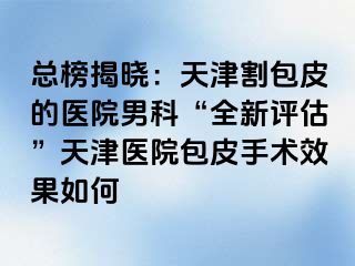 总榜揭晓:天津割包皮的医院男科“全新评估”天津医院包皮手术效果如何